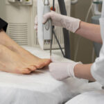 El médico realiza el procedimiento para el tratamiento de hongos en los pies.